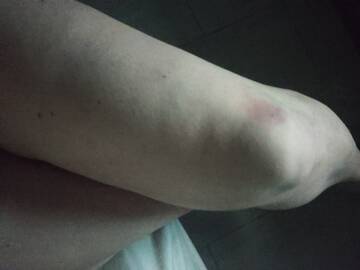 Gionocchia ben allenate